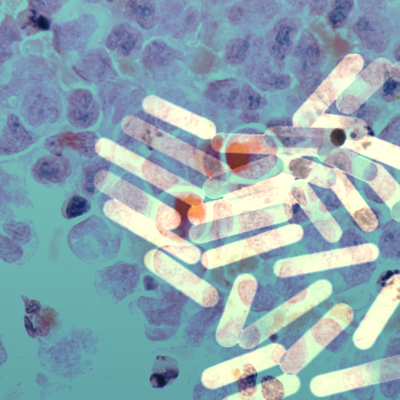 A microscopic image of gold nanoparticle