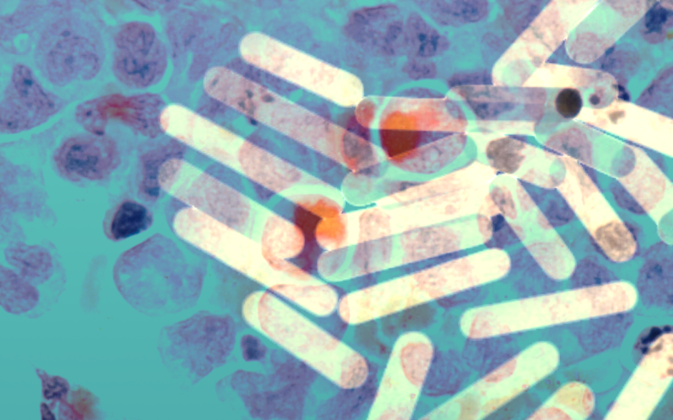 A microscopic image of gold nanoparticle