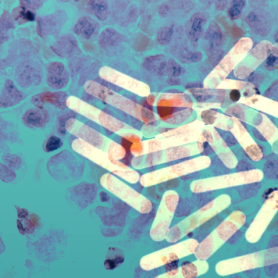 A microscopic image of gold nanoparticle