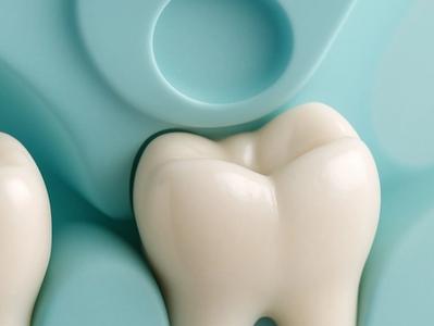 Sinus lifts