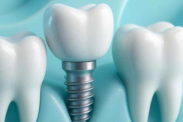 Tulītēja implantācija
