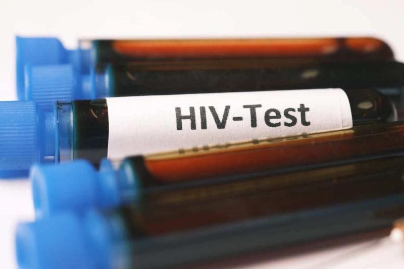 Wie zuverlässig ist ein HIV-Test nach 3 Wochen?