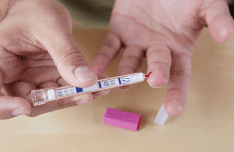 HIV-Schnelltest