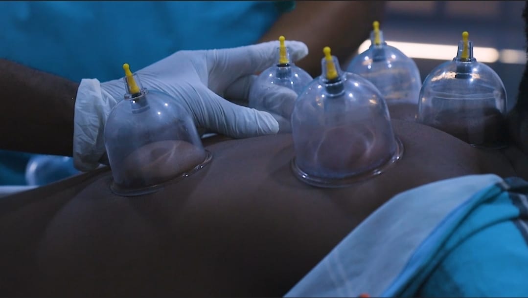 What Is Hijama Cupping Therapy? Benefits, How It Works, and Why You Should Do It