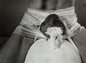 2 Aktion / 2nd Action, 1965