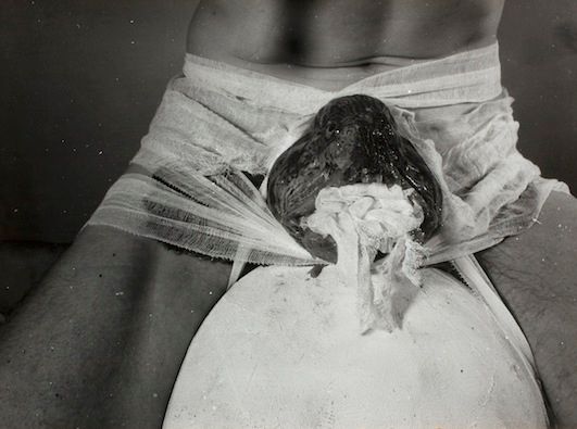 2 Aktion / 2nd Action, 1965
