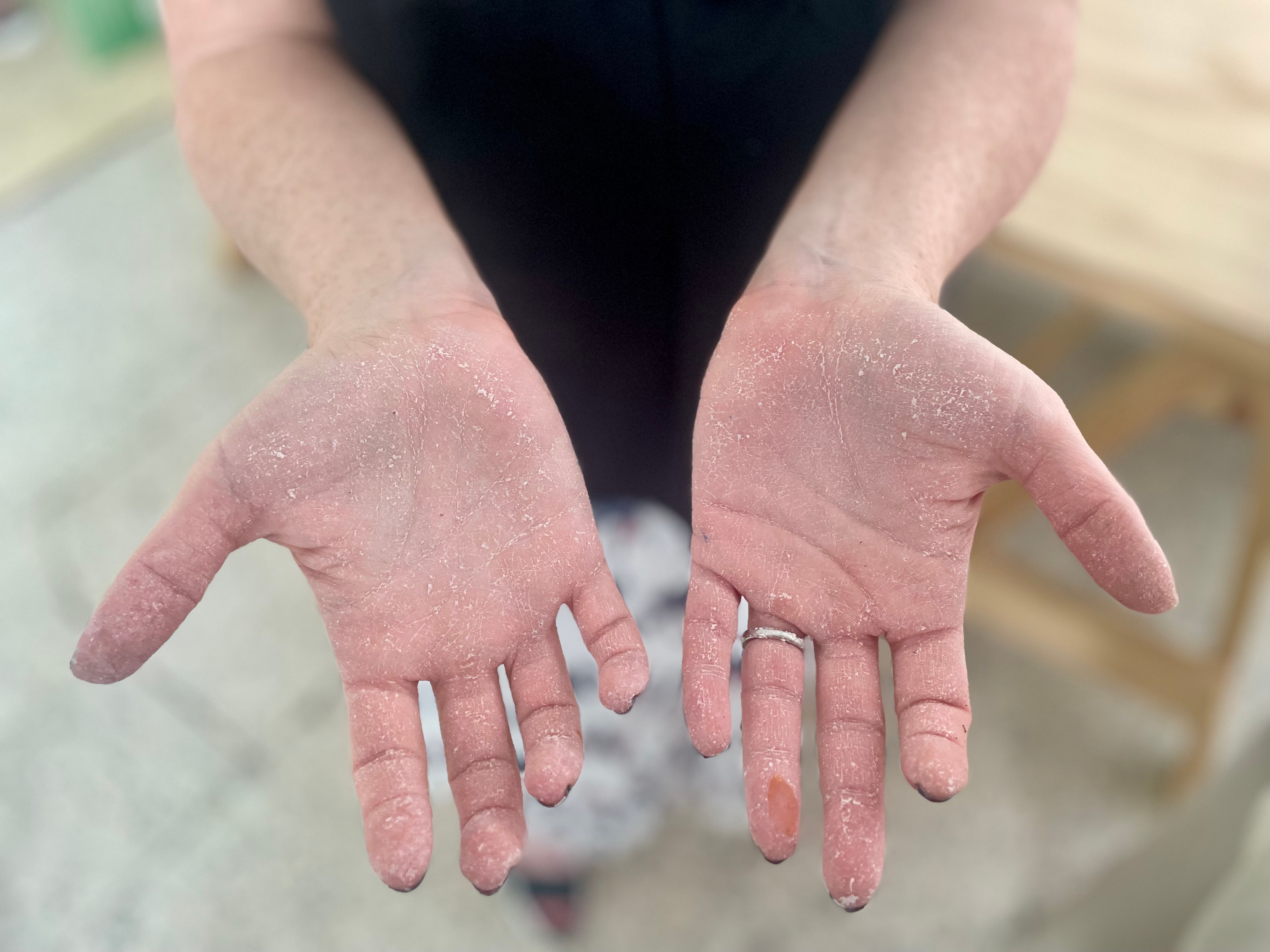Hands