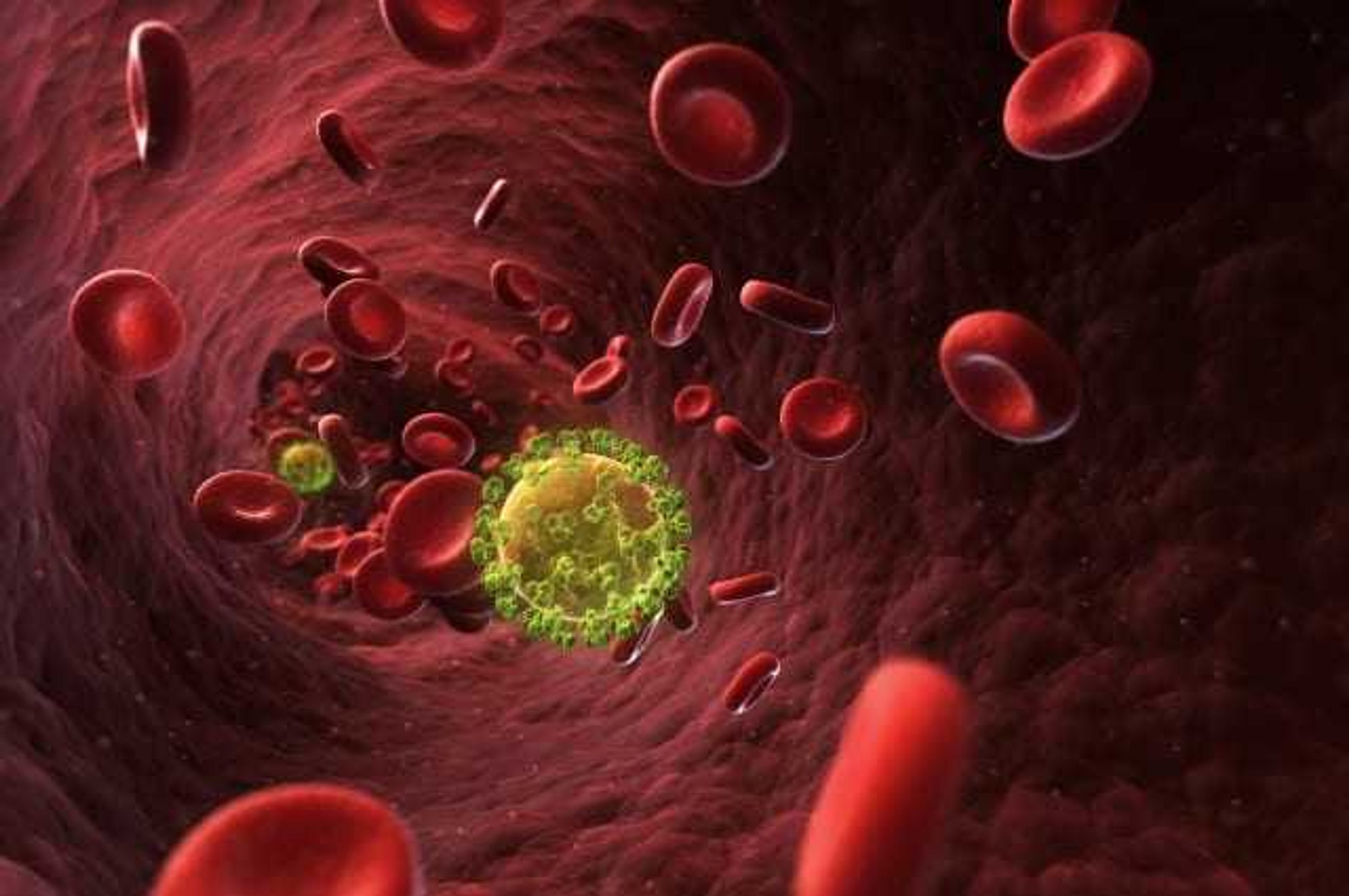 Kas yra ūmi ŽIV infekcija arba kur Klaipėdoje anonimiškai išsitirti dėl AIDS