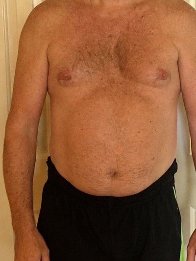 Before — Robert's weight-loss transformation