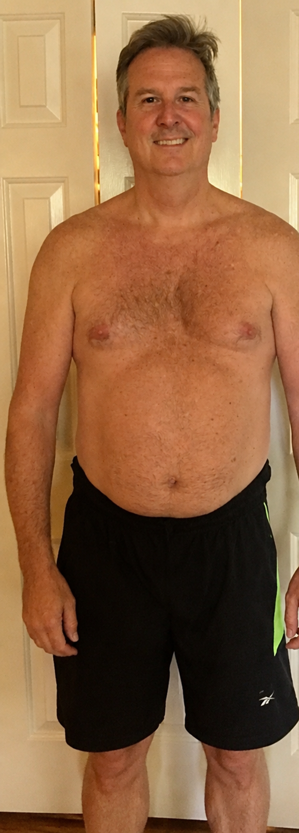 Before — Robert's weight-loss transformation