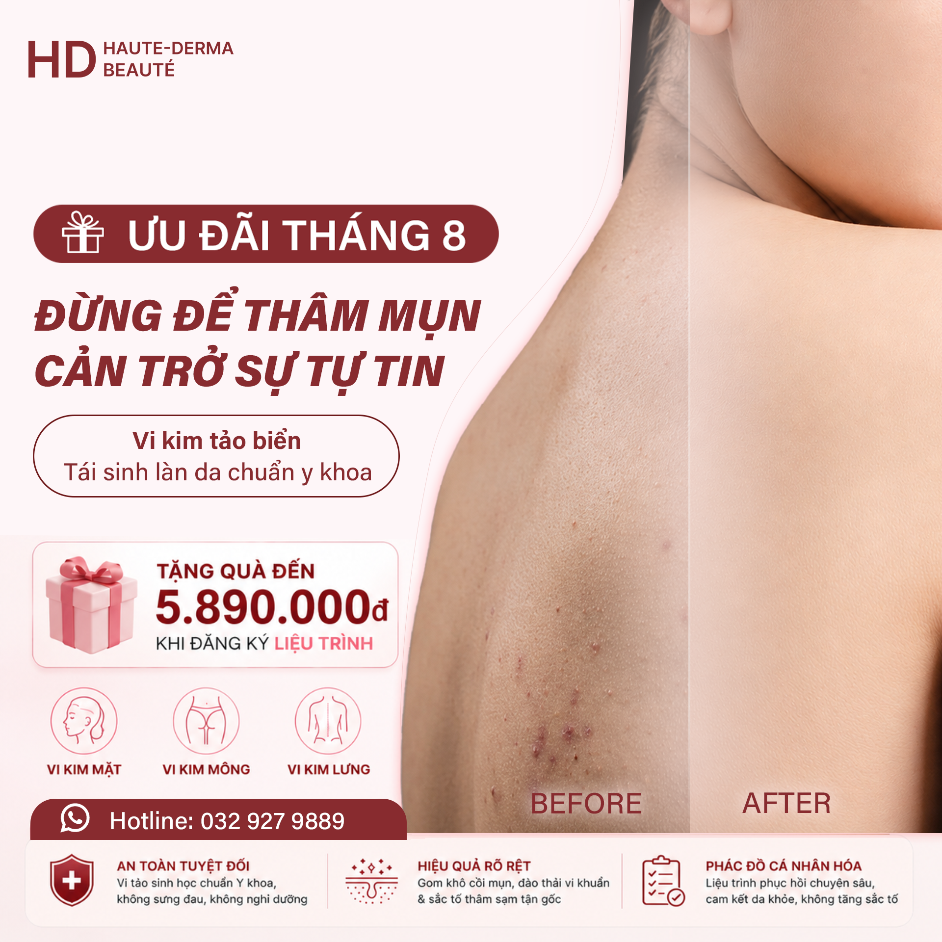 Ưu đãi Vi Kim Tảo Biển – Tặng chăm sóc phục hồi chuyên sâu