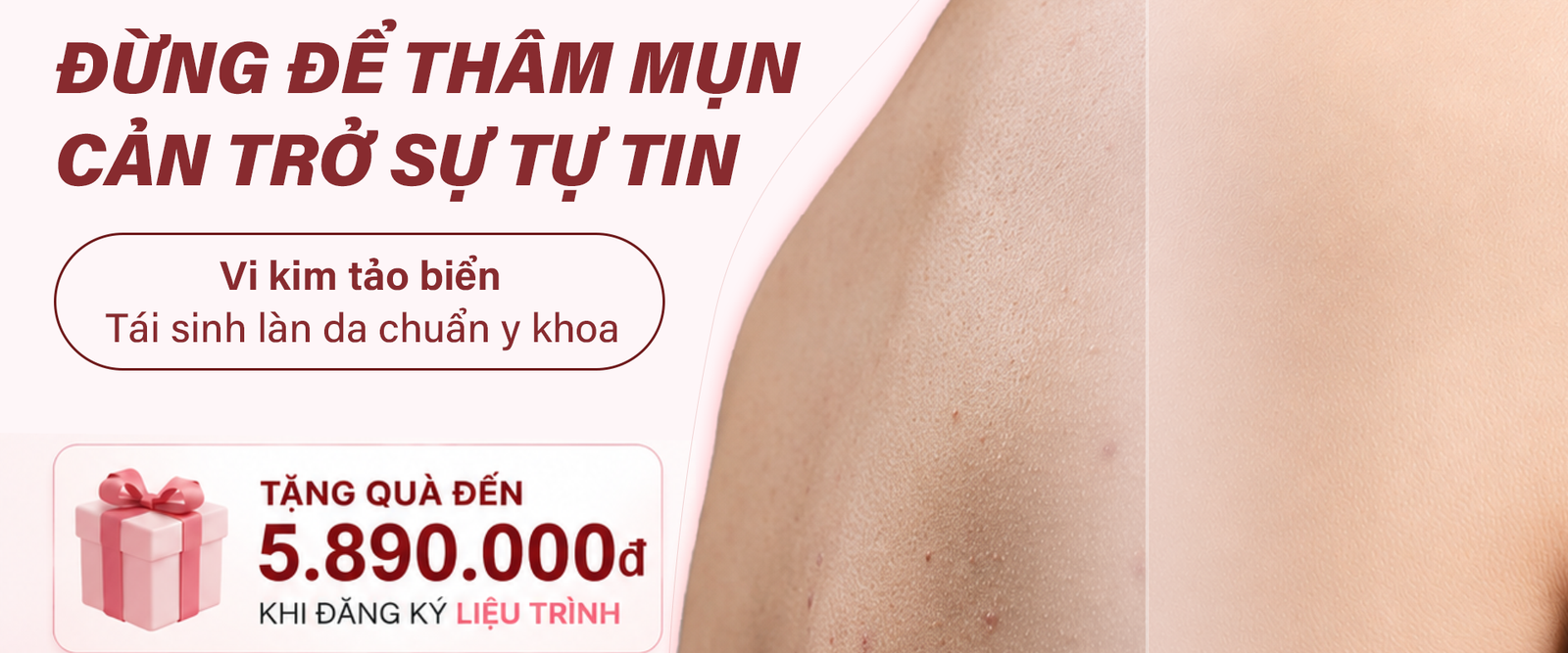 Ưu đãi Vi Kim Tảo Biển – Tặng chăm sóc phục hồi chuyên sâu