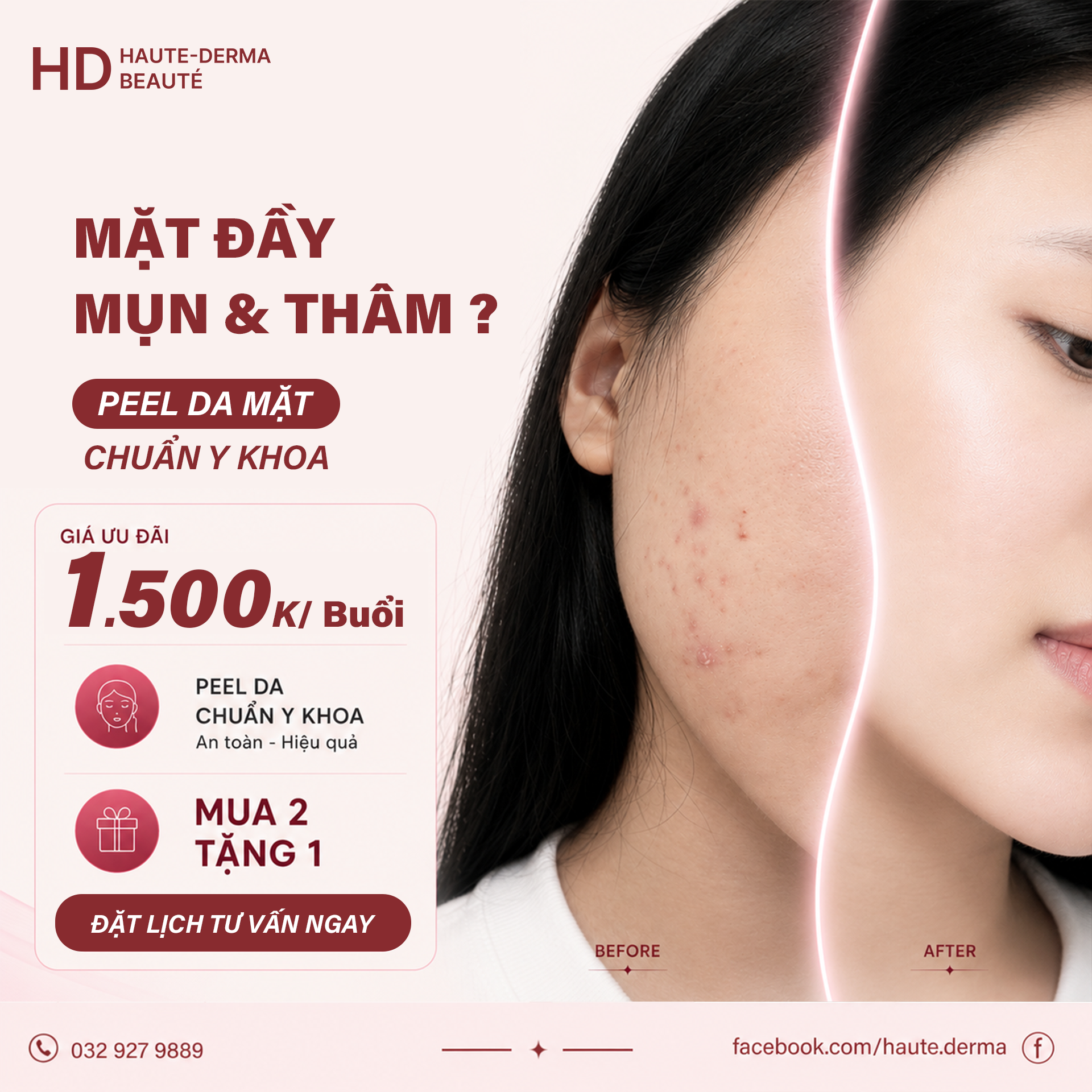 Thanh Lọc Làn Da – Sạch Mụn, Sáng Mịn