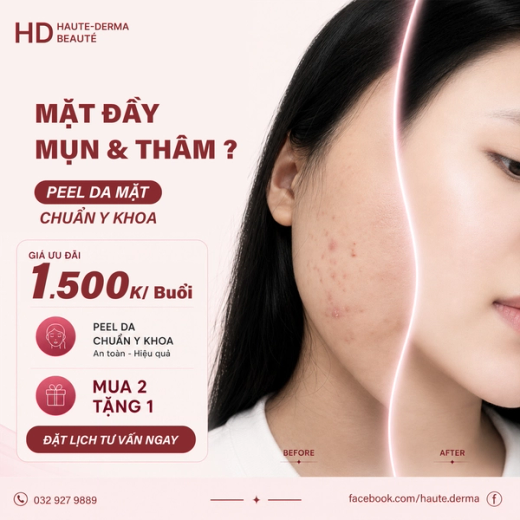 Thanh Lọc Làn Da – Sạch Mụn, Sáng Mịn