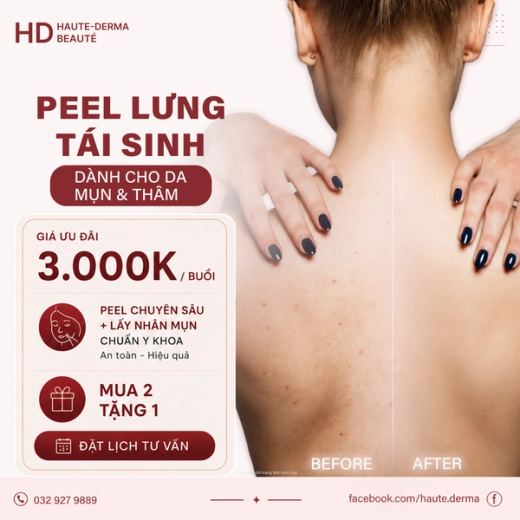 lấy mụn Tạm Biệt Mụn Lưng – Tự Tin Khoe Lưng Mịn