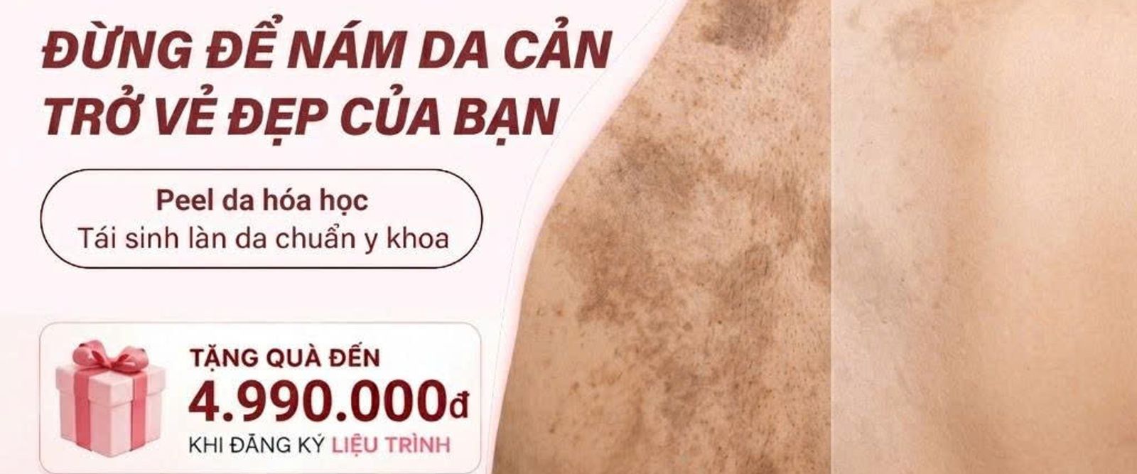 Tái Tạo Làn Da Lưng – Mịn Màng Từ Mọi Góc Nhìn