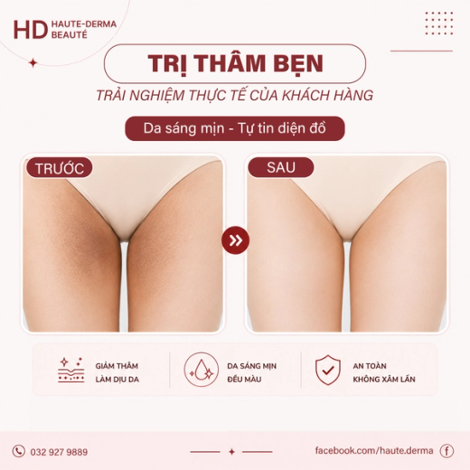 Vùng Bẹn Sáng Mịn – Tự Tin & Đều Màu Hơn