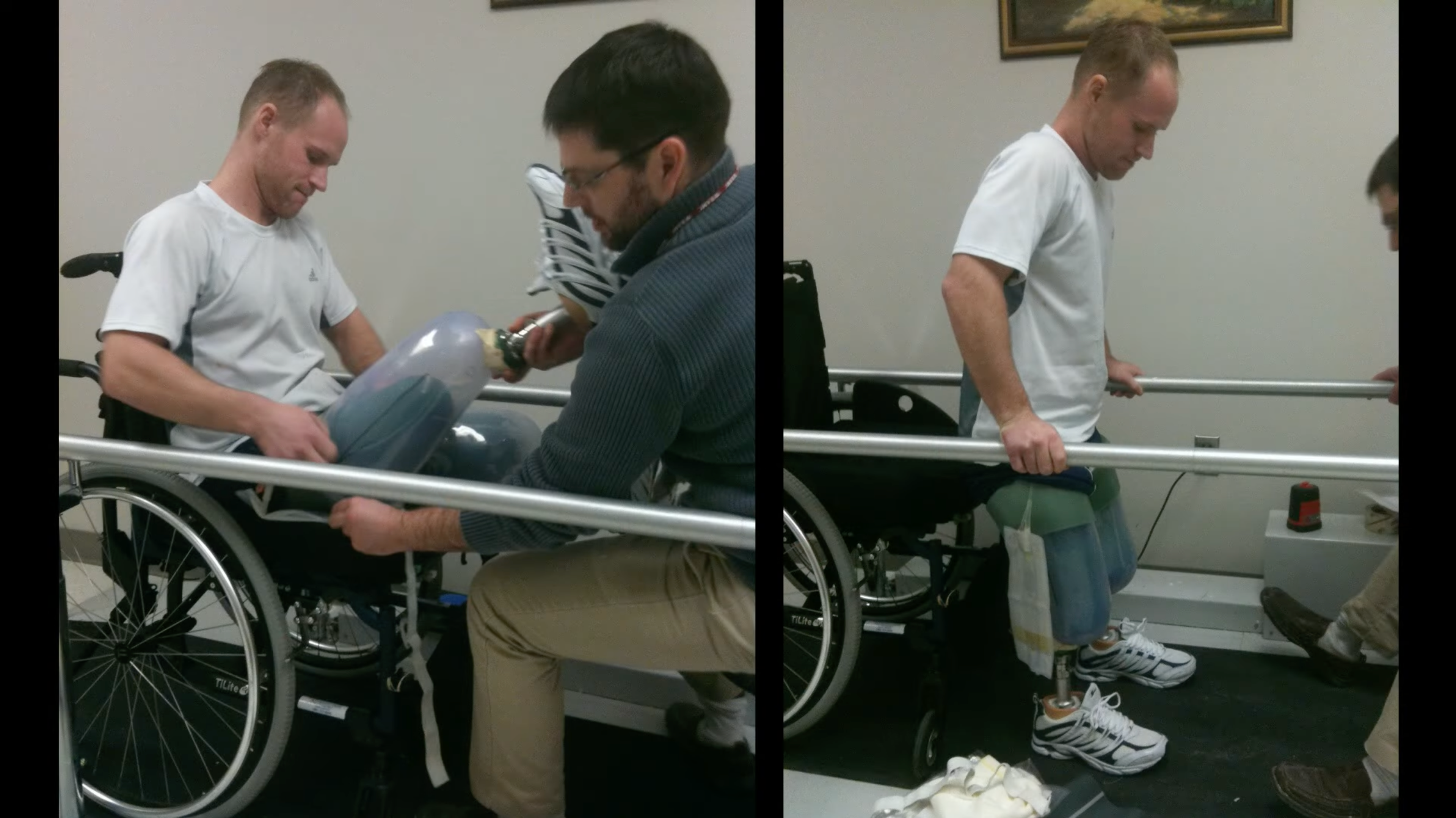 Dan Cnossen fits his prosthetic legs with a clinician's help, then stands using parallel bars during rehabilitation.