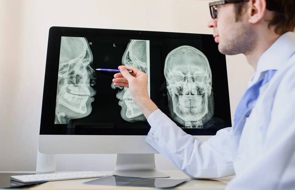 Doctor reviewing skull X-ray scans on a computer monitor and pointing to the jaw area.