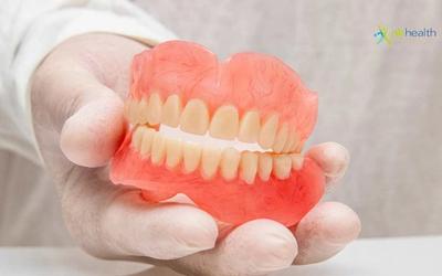 Jenis Pemasangan Gigi Palsu – Klinik Gigi NK Health