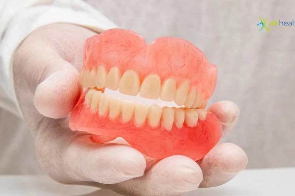 Jenis Pemasangan Gigi Palsu – Klinik Gigi NK Health