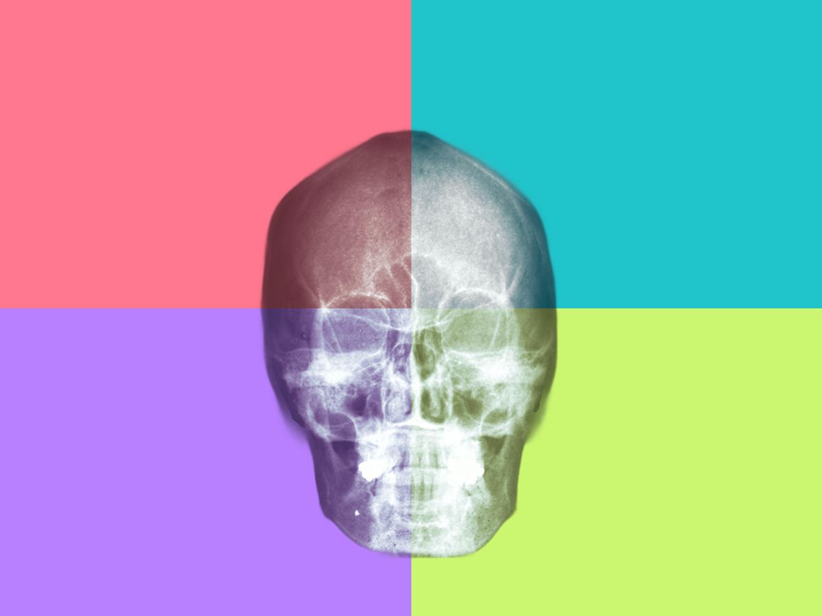 Winning by Differentiation