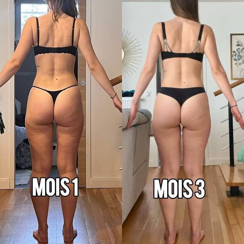 Transformation cliente M., vue de dos
