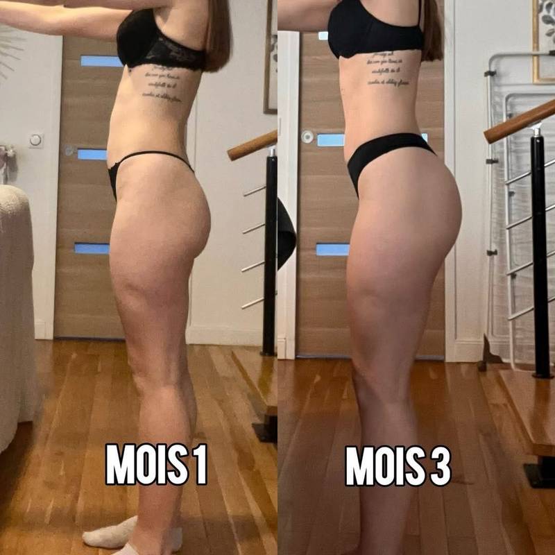 Transformation cliente M., vue de profil