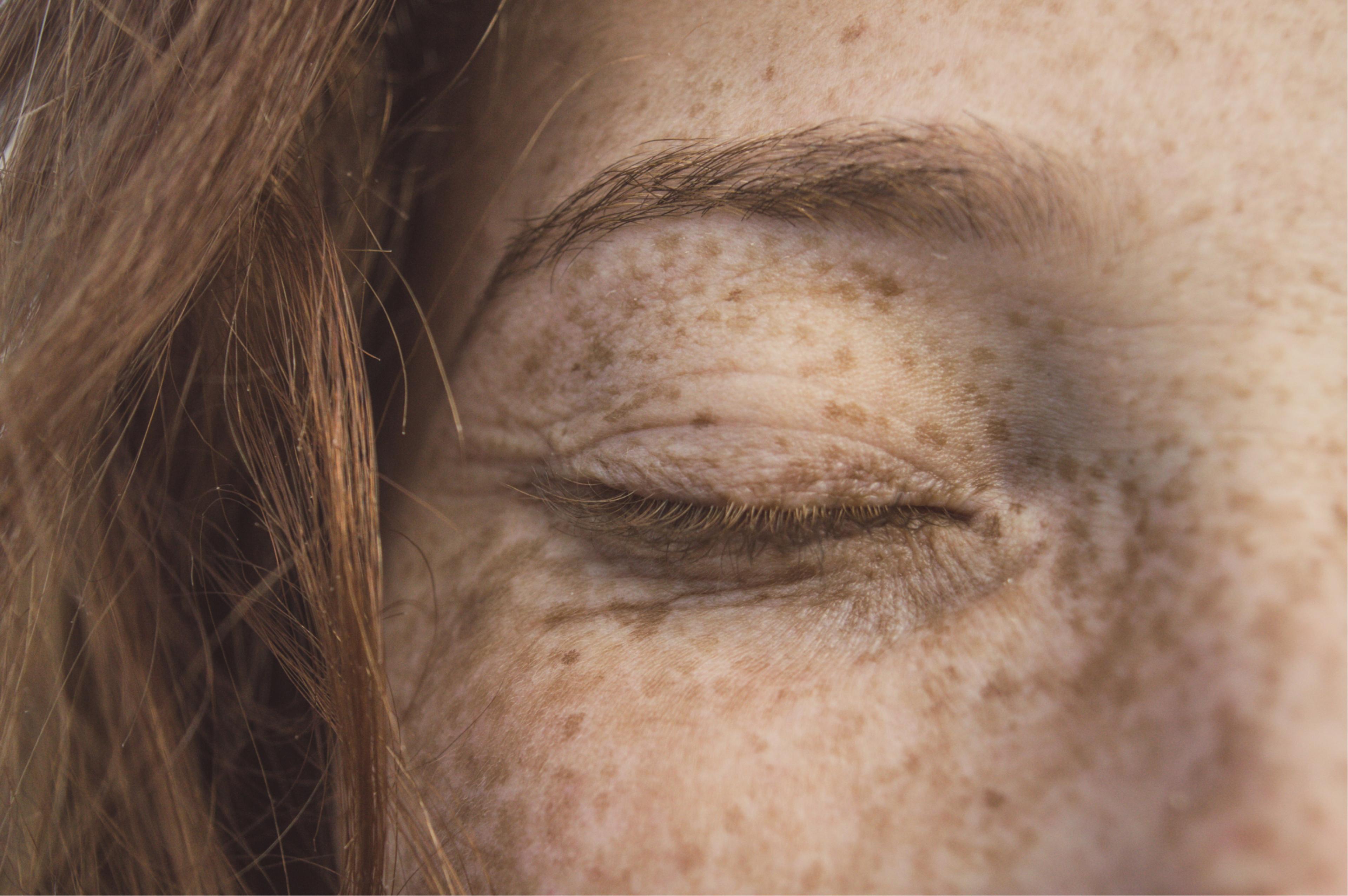 Bilde av kvinne med ett øye lukket
