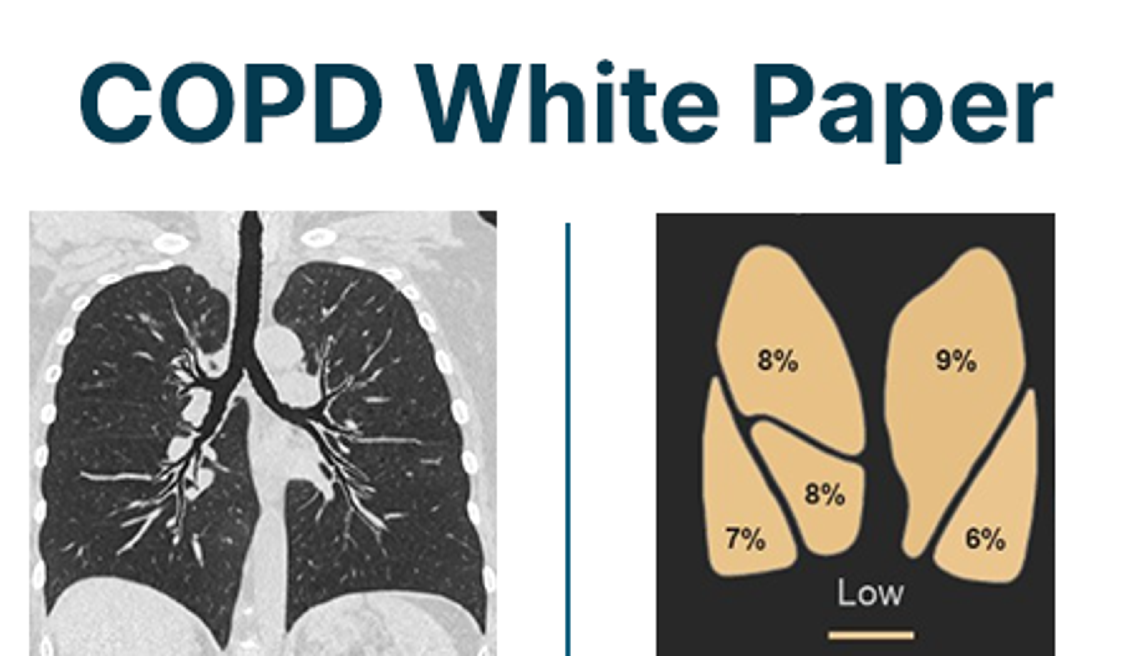 COPD Whitepaper
