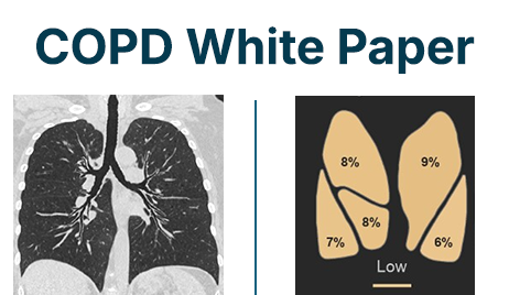 COPD Whitepaper