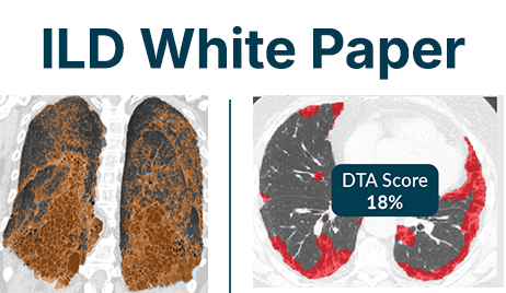 ILD Whitepaper