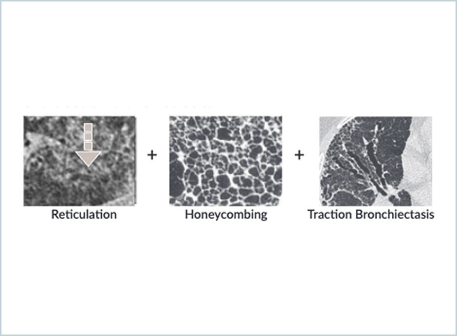 DTA Fibrosis Score Overview and Validation Papers