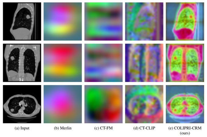 COLIPRI: A 3D Vision-Language Transformer Model