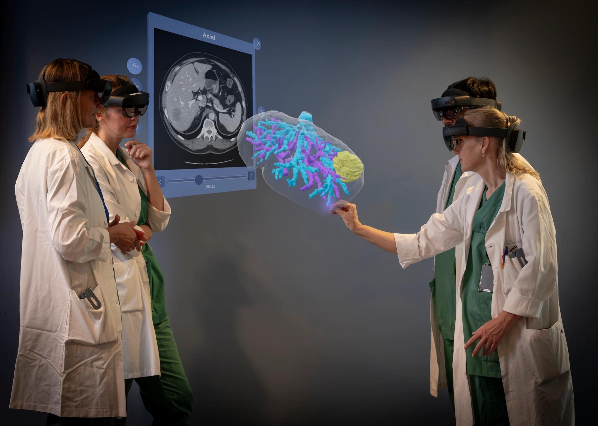 4 doctors looking at a hologram of a liver.