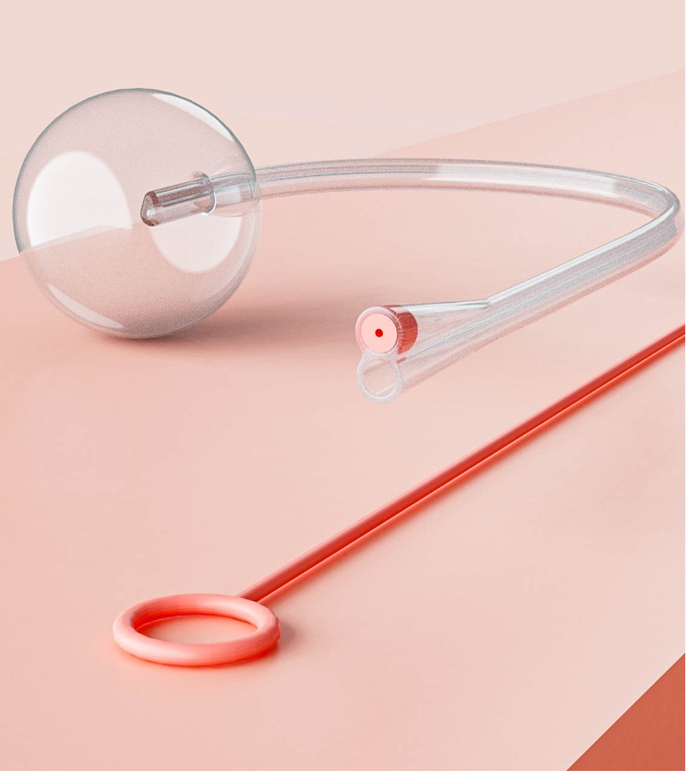 Iola induction catheter