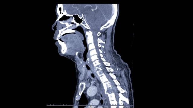 Spinal Trauma Assessment and Spinal Cord Injury — orthointerview.com