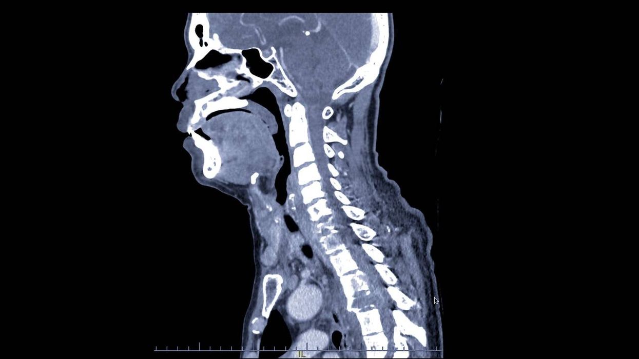 Spinal Trauma Assessment and Spinal Cord Injury — orthointerview.com