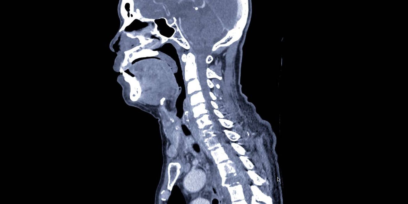 Spinal Trauma Assessment and Spinal Cord Injury — orthointerview.com