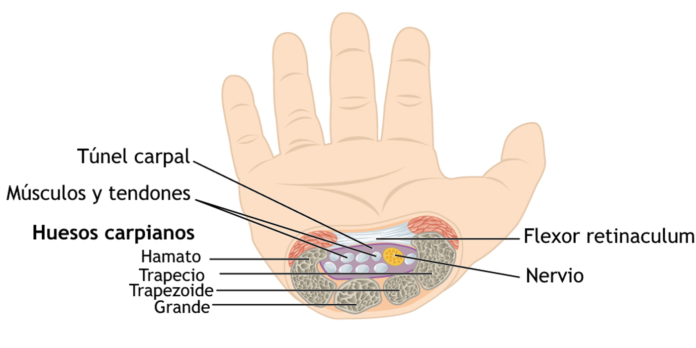 Carpal Tunnel Syndrome: Diagnosis, NICE CKS Management Ladder and Surgical Release — orthointerview.com