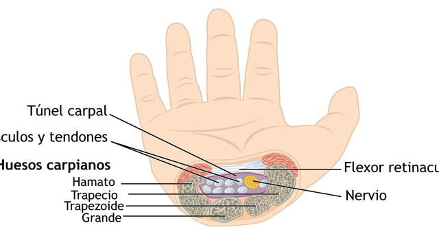 Carpal Tunnel Syndrome: Diagnosis, NICE CKS Management Ladder and Surgical Release — orthointerview.com