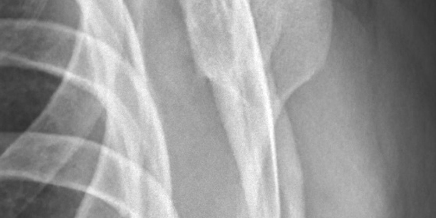 Shoulder Dislocation and Instability — orthointerview.com