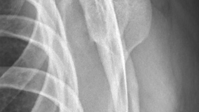 Shoulder Dislocation and Instability — orthointerview.com