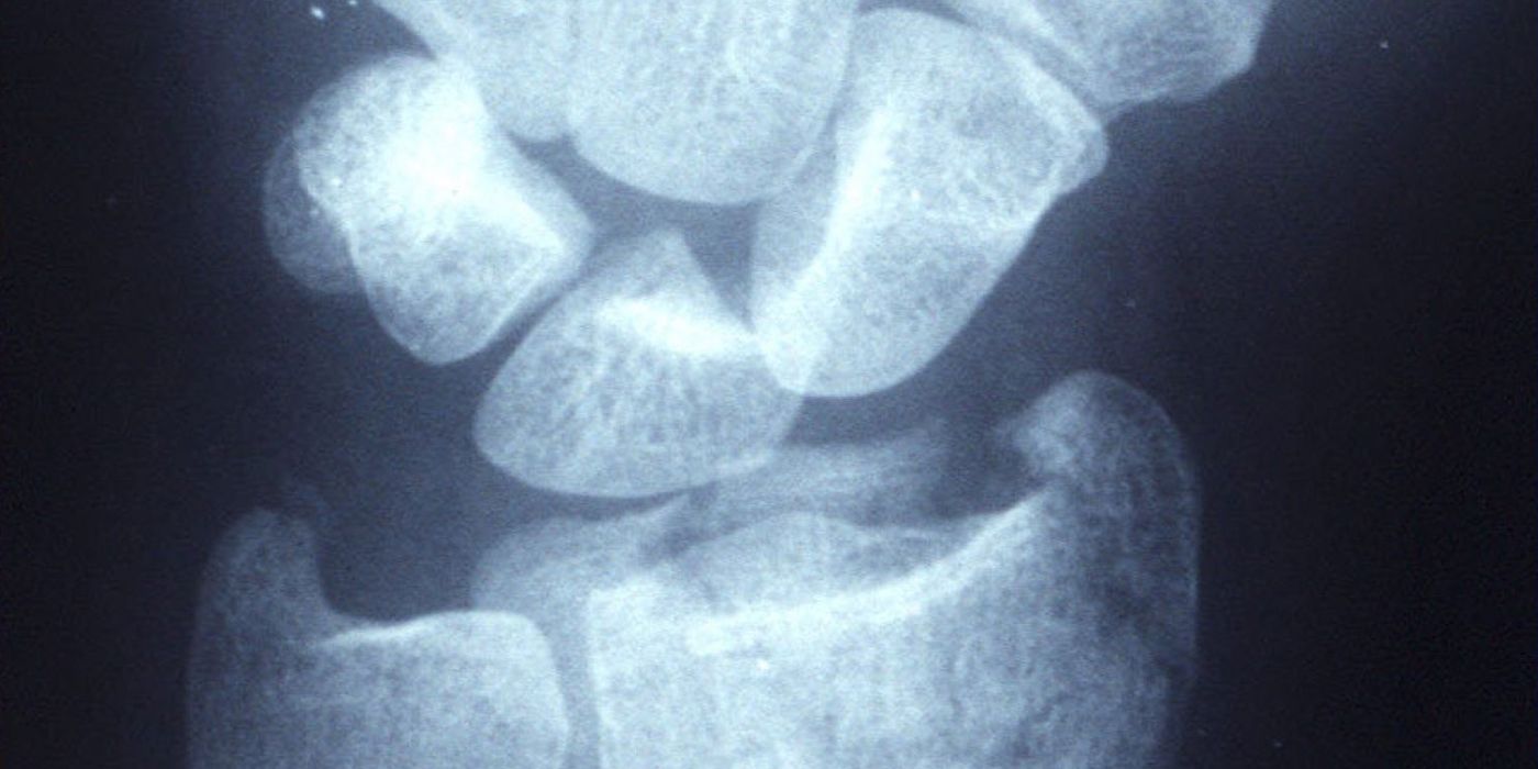 Distal Radius Fractures: Assessment, Management and the Evidence (BOAST, NICE NG38, DRAFFT) — orthointerview.com