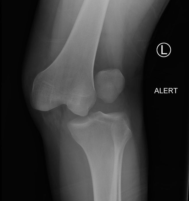 Knee Dislocation and Multiligament Injury — orthointerview.com