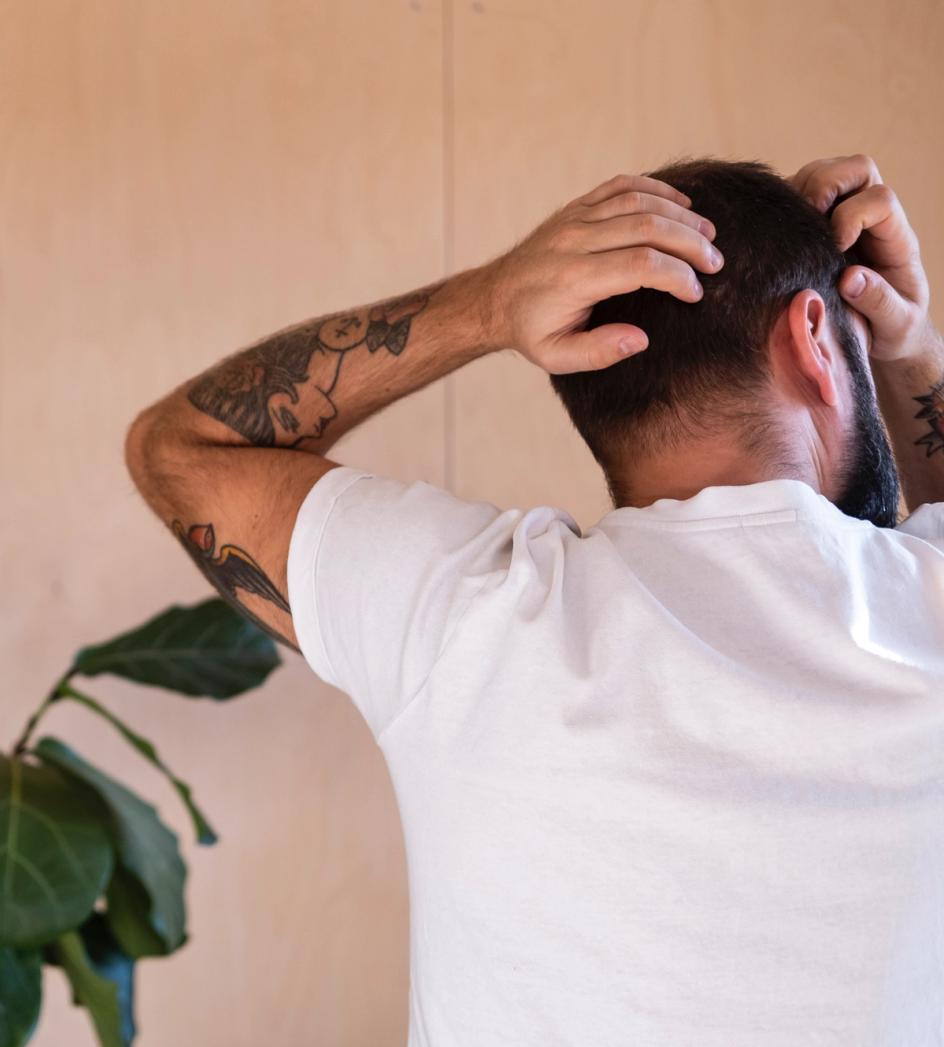 Mannlig hårtap – De ulike formene for alopeci og hva det kan skyldes