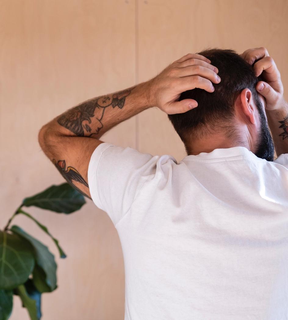 Mannlig hårtap – De ulike formene for alopeci og hva det kan skyldes