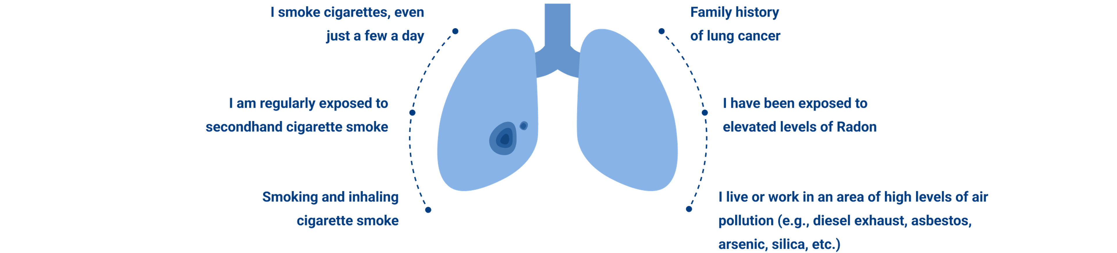 Lung Cancer Diagram