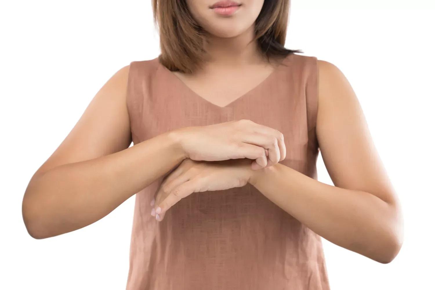 La dermatite atopique peut souvent affecter les mains – voici ce qu’il faut surveiller