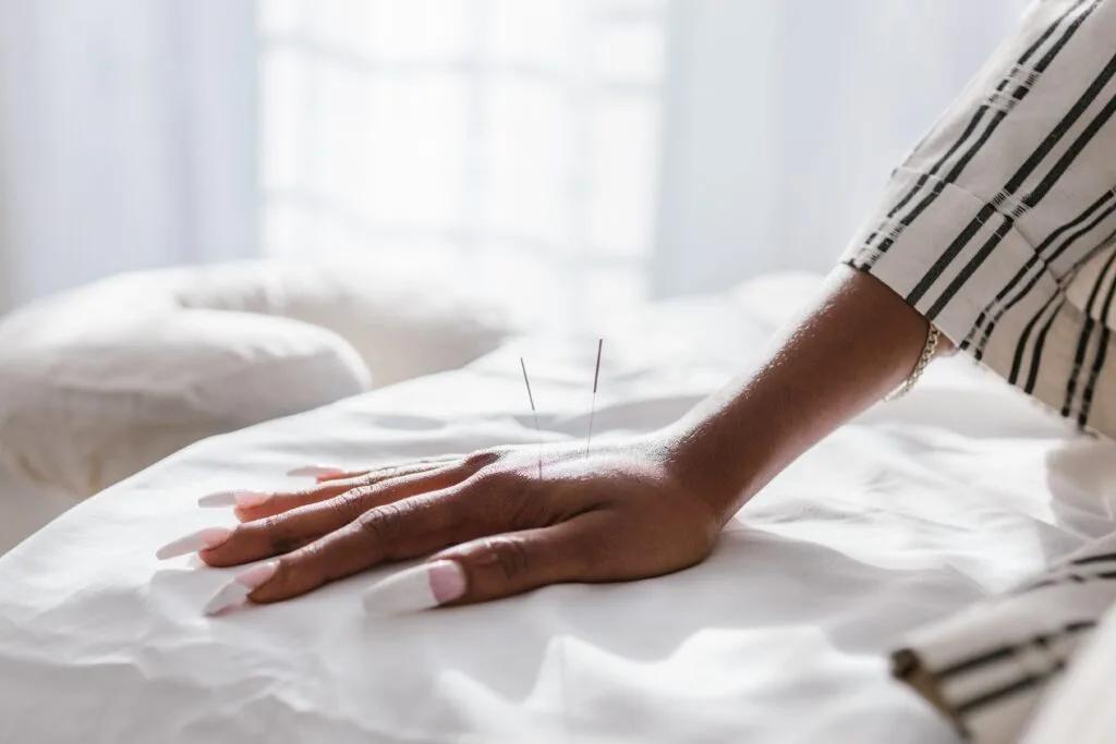 Femme enceinte - acupuncture